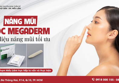 Nâng mũi bọc sụn Megaderm