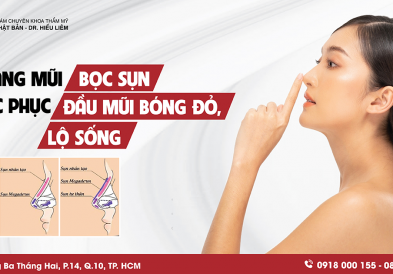 Nâng mũi bọc sụn