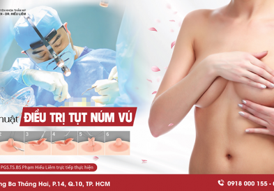 Phẫu thuật điều trị tụt núm vú