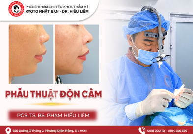 Phẫu Thuật Độn Cằm