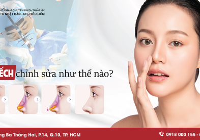 Chỉnh sửa mũi hếch