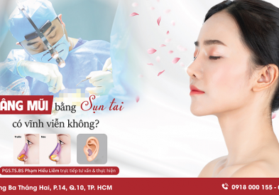 Nâng mũi sụn tai có vĩnh viễn không?