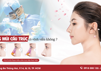 Nâng mũi cấu trúc có vĩnh viễn không?