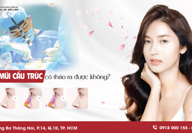 Nâng mũi cấu trúc có tháo ra được không?