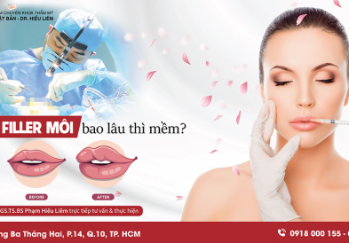 Tiêm filler môi bao lâu thì mềm?