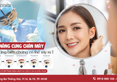 Biến chứng nâng cung chân mày