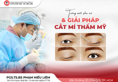 Tướng mắt phụ nữ & Giải pháp cắt mí thẩm mỹ