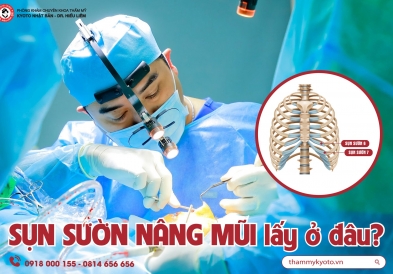 Nâng mũi sụn sườn
