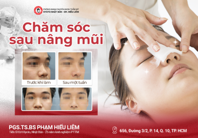 Chăm sóc sau nâng mũi