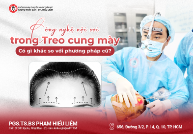 Công nghệ nội soi trong Treo cung mày – Có gì khác so với phương pháp cũ?