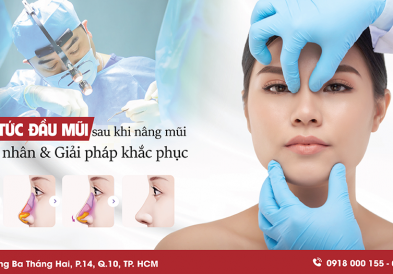Căng tức đầu mũi sau khi nâng mũi