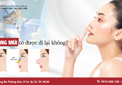 Sau khi nâng mũi có được đi lại không?