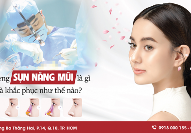 Dị ứng sụn nâng mũi