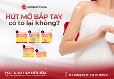 Hút mỡ bắp tay có to lại không?
