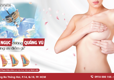 Nâng ngực đường quầng vú