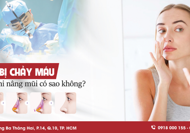 Nâng mũi 1 tháng bị chảy máu