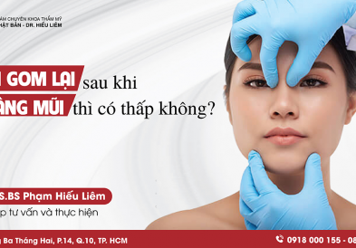 Nâng mũi gom lại có thấp không?