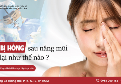 Sửa mũi hỏng sau nâng mũi