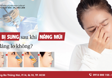 Nâng mũi bị sưng