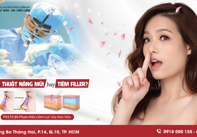 Nên tiêm filler hay nâng mũi