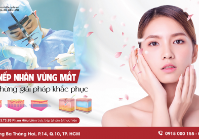 Xóa nếp nhăn vùng mắt