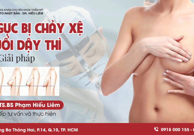 Ngực bị chảy xệ tuổi dậy thì