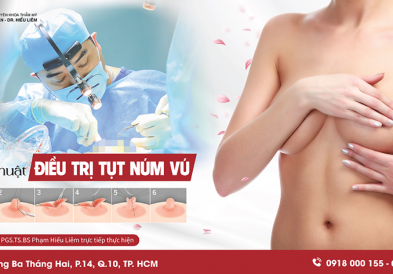 Phẫu thuật điều trị tụt núm vú
