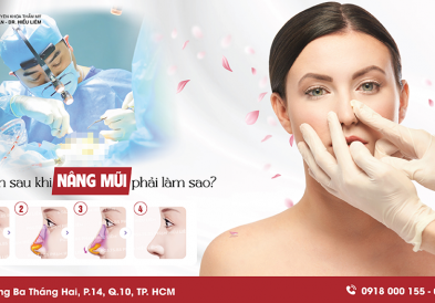 Mũi bị lệch sau khi nâng