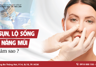 Nâng mũi bị lộ sụn, lộ sống