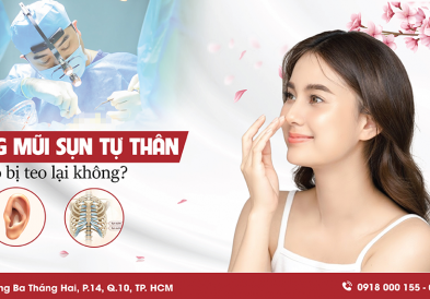Nâng mũi bằng sụn tự thân có bị teo không?
