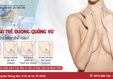 Treo sa trễ đường quầng vú