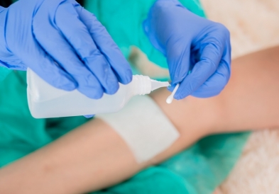 Vết thương có mủ: Dấu hiệu nhiễm trùng vết thương